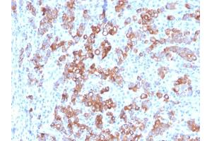 Image no. 3 for anti-Hepatitis A Virus Cellular Receptor 2 (TIM 3) (AA 22-202) antibody (ABIN6940963)