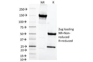 Image no. 2 for anti-Mastermind-Like 2 (MAML2) antibody (ABIN5707979)