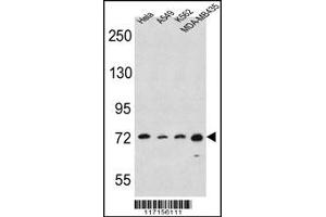Western Blotting (WB) image for anti-Arachidonate 15-Lipoxygenase (ALOX15) (C-Term) antibody (ABIN2159070)