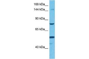 Image no. 2 for anti-Transmembrane Protein 2 (TMEM2) (Middle Region) antibody (ABIN2775385)