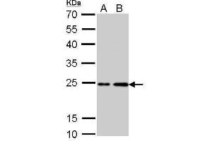 Image no. 6 for anti-HRas proto-oncogene, GTPase (HRAS) (C-Term) antibody (ABIN2857002)