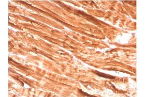 Image no. 3 for anti-Dystrophin (DMD) (AA 114-263) antibody (ABIN6939242)