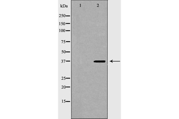 anti-Torsin Family 1, Member A (Torsin A) (TOR1A) (Internal Region) antibody