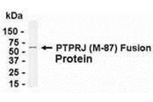 Image no. 1 for anti-Protein tyrosine Phosphatase, Receptor Type, J (PTPRJ) (AA 206-292) antibody (ABIN2467997)