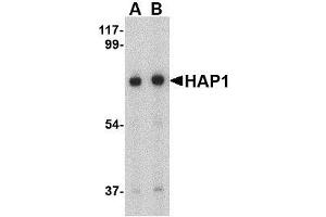 Image no. 2 for anti-Huntingtin Associated Protein 1 (HAP1) (Center) antibody (ABIN499942)