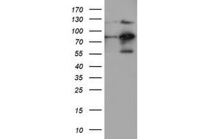 Image no. 2 for anti-Folate Hydrolase (Prostate-Specific Membrane Antigen) 1 (FOLH1) antibody (ABIN1500454)