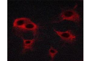Image no. 5 for anti-VEGF Receptor 2 (VEGFR2) (pTyr951) antibody (ABIN6256071)
