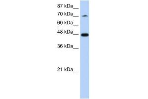 Image no. 1 for anti-Splicing Factor 3b, Subunit 4, 49kDa (SF3B4) (N-Term) antibody (ABIN2778952)
