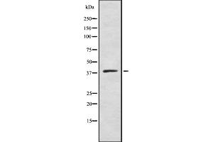 Image no. 2 for anti-Zinc Finger, DHHC-Type Containing 9 (ZDHHC9) (C-Term) antibody (ABIN6261286)