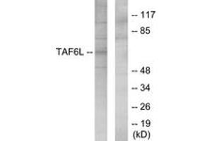 Image no. 1 for anti-TAF6-Like RNA Polymerase II, P300/CBP-Associated Factor (PCAF)-Associated Factor, 65kDa (TAF6L) (AA 31-80) antibody (ABIN1534226)