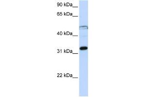 Image no. 1 for anti-Eukaryotic Translation Initiation Factor 3, Subunit G (EIF3G) (Middle Region) antibody (ABIN2778865)