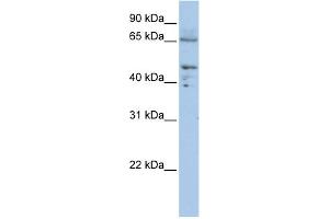 Image no. 1 for anti-Dihydrolipoyl Transacetylase (DLAT) (C-Term) antibody (ABIN2777102)