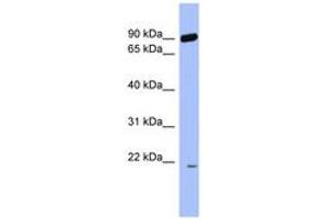 Image no. 1 for anti-Ring Finger Protein 135 (RNF135) (AA 107-156) antibody (ABIN6741634)