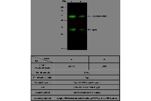Image no. 2 for anti-Bone Marrow Stromal Cell Antigen 1 (BST1) (AA 1-285) antibody (ABIN2000757)