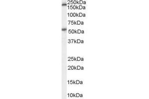 Image no. 2 for anti-Serotonin Receptor 3A (HTR3A) (Internal Region) antibody (ABIN185673)