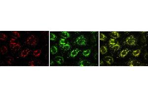 Image no. 1 for anti-Vesicle-Associated Membrane Protein 7 (VAMP7) antibody (ABIN1109463)