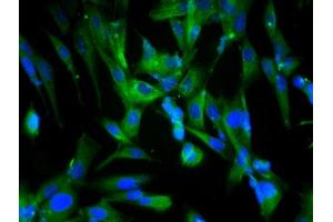 Image no. 7 for anti-Beclin 1, Autophagy Related (BECN1) (AA 201-330) antibody (ABIN675384)