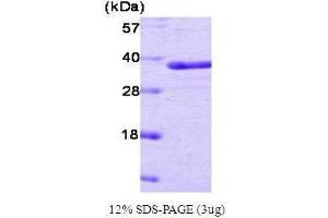 Image no. 1 for Protein tyrosine Phosphatase, Non-Receptor Type 1 (PTPN1) (Active) protein (ABIN934895)