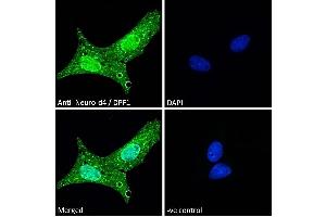 Image no. 3 for anti-D4, Zinc and Double PHD Fingers Family 1 (DPF1) (C-Term) antibody (ABIN184922)