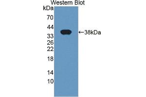Image no. 1 for anti-LIM and SH3 Protein 1 (LASP1) (AA 1-261) antibody (ABIN1868910)