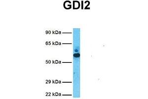 Image no. 3 for anti-GDP Dissociation Inhibitor 2 (GDI2) (C-Term) antibody (ABIN2792268)
