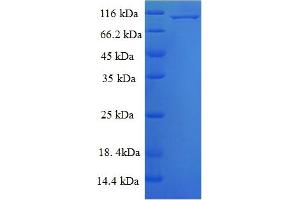 Image no. 1 for Mitogen-Activated Protein Kinase 6 (MAPK6) (AA 1-721), (full length) protein (His-SUMO Tag) (ABIN5709907)