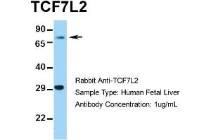 Image no. 4 for anti-Transcription Factor 7-Like 2 (T-Cell Specific, HMG-Box) (TCF7L2) (Middle Region) antibody (ABIN2777927)