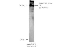 Image no. 4 for SARS-CoV-2 Spike (P.1 - gamma) protein (rho-1D4 tag) (ABIN6964443)