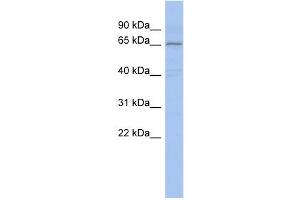 Image no. 1 for anti-Protein Inhibitor of Activated STAT, 1 (PIAS1) (Middle Region) antibody (ABIN2780998)