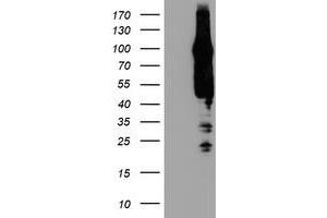 Image no. 2 for anti-ArfGAP with GTPase Domain, Ankyrin Repeat and PH Domain 1 (AGAP1) antibody (ABIN1497475)
