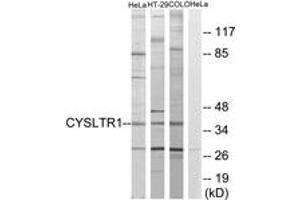 Image no. 1 for anti-Cysteinyl Leukotriene Receptor 1 (CYSLTR1) (AA 131-180) antibody (ABIN1535582)