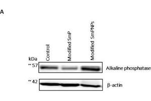 Image no. 3 for anti-Alkaline Phosphatase (ALP) (Center) antibody (ABIN2856846)