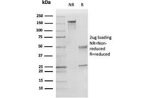 Image no. 1 for anti-Cyclin-Dependent Kinase Inhibitor 1B (p27, Kip1) (CDKN1B) antibody (ABIN6939046)