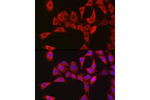 Immunofluorescence analysis of NIH/3T3 cells using RBCK1 antibody (ABIN7269848) at dilution of 1:100.