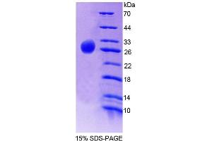 Image no. 1 for Fibronectin Leucine Rich Transmembrane Protein 2 (FLRT2) (AA 300-517) protein (His tag) (ABIN6239107)