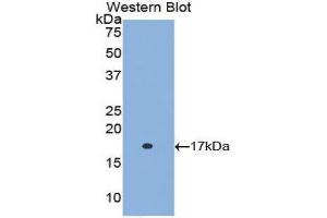 Image no. 1 for anti-Retinol Binding Protein 5, Cellular (RBP5) (AA 1-135) antibody (ABIN1078488)