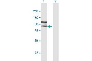 Image no. 2 for anti-Zinc Finger, FYVE Domain Containing 9 (ZFYVE9) (AA 1-762) antibody (ABIN948795)