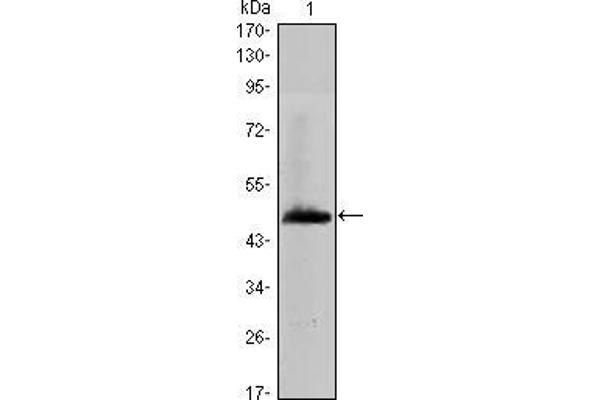 anti-Hyaluronan Synthase 1 (HAS1) antibody