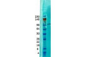 Image no. 1 for anti-Calcium/calmodulin-Dependent serine Protein Kinase (MAGUK Family) (CASK) antibody (ABIN6658140)
