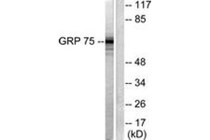 Image no. 1 for anti-Heat Shock 70kDa Protein 9 (Mortalin) (HSPA9) (AA 630-679) antibody (ABIN1533297)