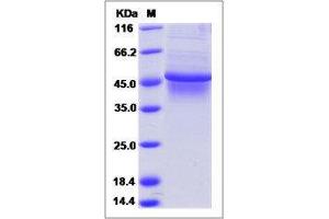 Image no. 1 for TAP Binding Protein (Tapasin) (TAPBP) (AA 1-414) protein (His tag) (ABIN2216083)