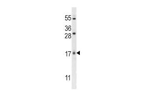 Western Blotting (WB) image for anti-Chromosome 1 Open Reading Frame 144 (C1orf144) (N-Term) antibody (ABIN2159646)