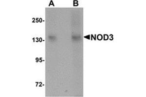 Image no. 1 for anti-NLR Family, CARD Domain Containing 3 (NLRC3) (Center) antibody (ABIN783697)