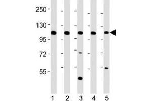 Image no. 1 for anti-C-Mer Proto-Oncogene Tyrosine Kinase (MERTK) (C-Term) antibody (ABIN3030226)