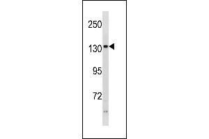 Image no. 1 for anti-Phosphorylase Kinase, alpha 2 (PHKA2) (AA 285-314), (N-Term) antibody (ABIN1881651)