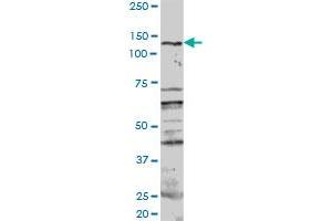 Image no. 1 for anti-Protein Kinase N1 (PKN1) (AA 1-942) antibody (ABIN950034)
