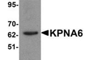Image no. 1 for anti-Karyopherin alpha 6 (Importin alpha 7) (KPNA6) (N-Term) antibody (ABIN783737)