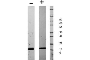 Image no. 2 for CD40 Ligand (CD40LG) protein (ABIN6699584)