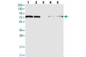 Image no. 2 for anti-TBC1 Domain Family, Member 15 (TBC1D15) antibody (ABIN5589225)