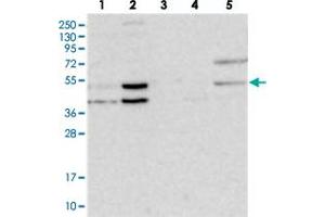 Image no. 2 for anti-Non-SMC Element 4 Homolog A (NSMCE4A) antibody (ABIN5584777)